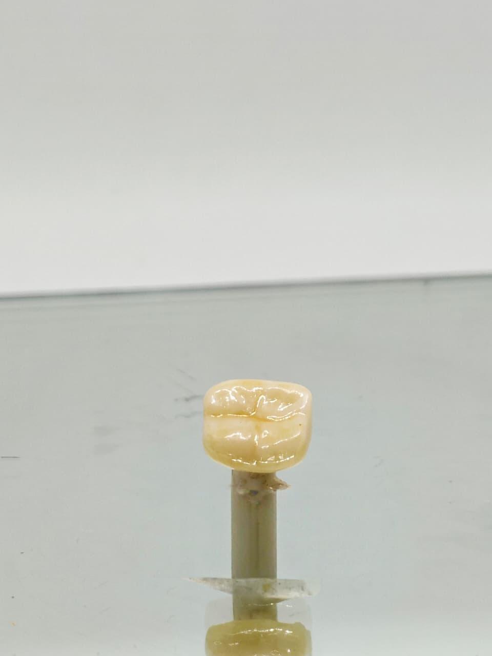 Implants & Dentures