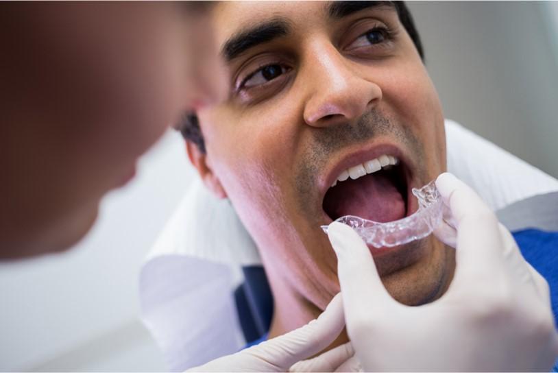 Smile Designing